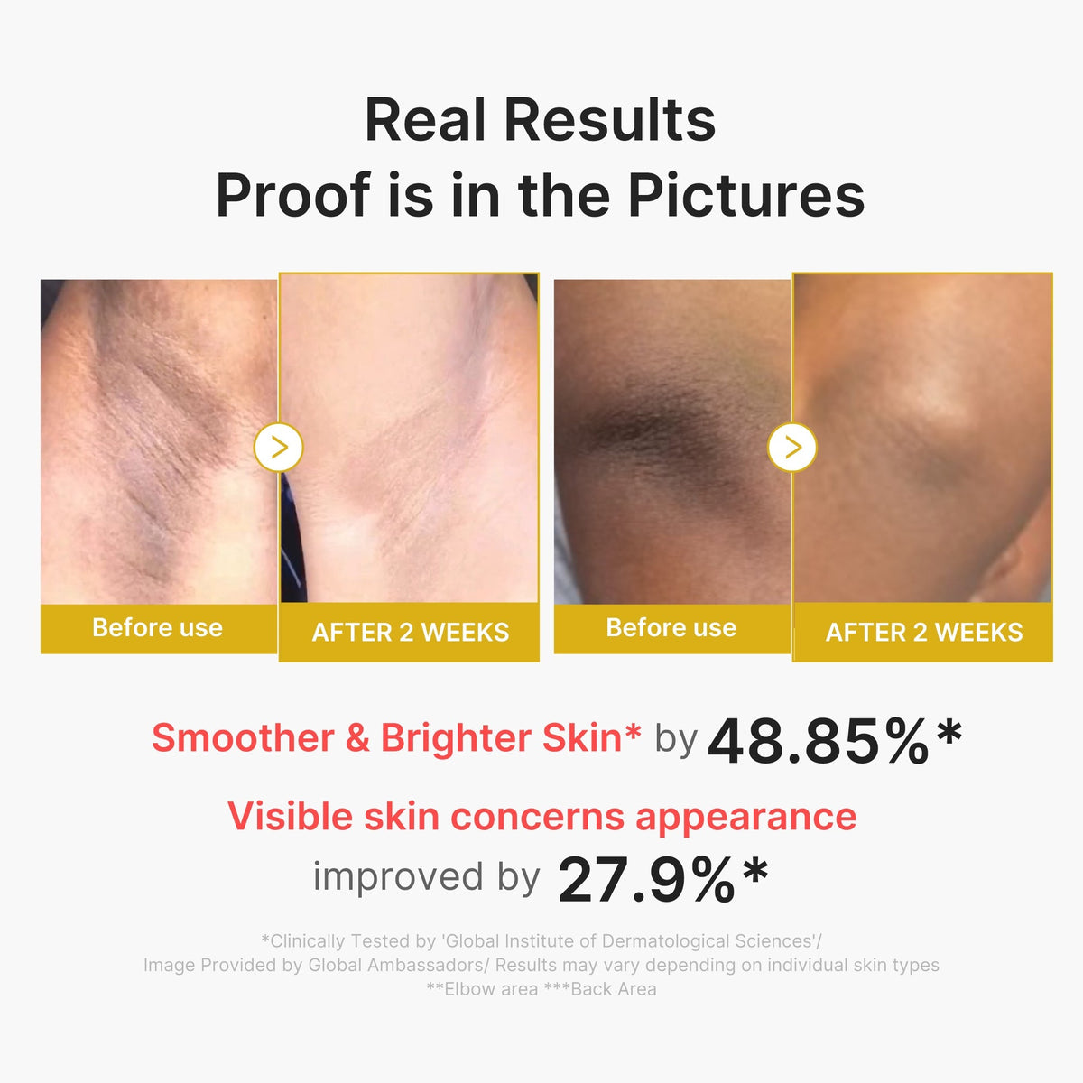 Peeling do ciała z kwasem kojowym i kurkumą Body Peel Shot