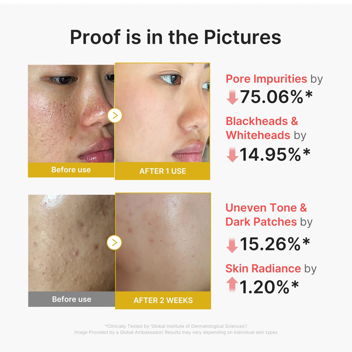 Peeling z kwasem kojowym i kurkumą Peel Shot