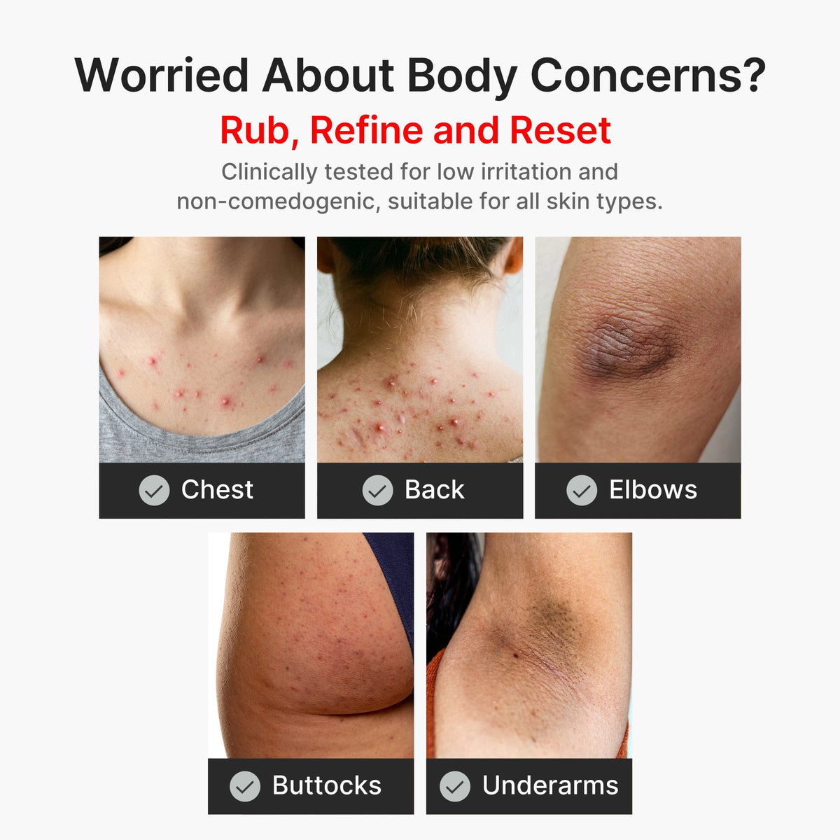 Peeling do ciała z kwasem kojowym i kurkumą Body Peel Shot